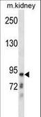 Chloride Voltage-Gated Channel Kb antibody, LS-C168807, Lifespan Biosciences, Western Blot image 