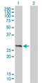 High Mobility Group Box 1 antibody, LS-C104965, Lifespan Biosciences, Western Blot image 