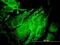 Ribosomal Protein S6 Kinase B1 antibody, H00006198-M04, Novus Biologicals, Immunofluorescence image 