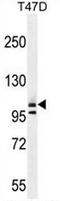 Collagen Type I Alpha 2 Chain antibody, AP51013PU-N, Origene, Western Blot image 