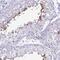 Chromosome 4 Open Reading Frame 33 antibody, NBP2-32585, Novus Biologicals, Immunohistochemistry paraffin image 