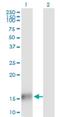 Tubulin Folding Cofactor A antibody, H00006902-M03, Novus Biologicals, Western Blot image 