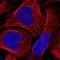 Activin A Receptor Type 2A antibody, NBP1-91647, Novus Biologicals, Immunofluorescence image 