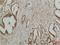 Mitogen-Activated Protein Kinase 7 antibody, STJ97386, St John