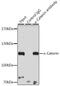 Catenin Alpha 1 antibody, GTX32433, GeneTex, Immunoprecipitation image 