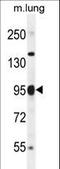 Poly(ADP-Ribose) Polymerase Family Member 9 antibody, LS-C163377, Lifespan Biosciences, Western Blot image 