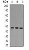 Propionyl-CoA Carboxylase Subunit Beta antibody, LS-B16060, Lifespan Biosciences, Western Blot image 