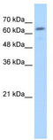 GUSB antibody, TA334656, Origene, Western Blot image 