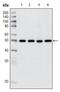 Histone deacetylase 3 antibody, AM06267SU-N, Origene, Western Blot image 