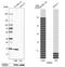 Phosphodiesterase 6D antibody, HPA037433, Atlas Antibodies, Western Blot image 