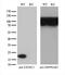 Exosome Component 1 antibody, M10811, Boster Biological Technology, Western Blot image 