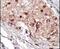 Sphingosine Kinase 1 antibody, PA5-14068, Invitrogen Antibodies, Immunohistochemistry paraffin image 