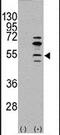 Myocyte Enhancer Factor 2C antibody, PA5-13289, Invitrogen Antibodies, Western Blot image 