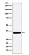 Mediator Complex Subunit 4 antibody, M06467, Boster Biological Technology, Western Blot image 