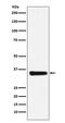 Mediator of RNA polymerase II transcription subunit 4 antibody, M06467, Boster Biological Technology, Western Blot image 