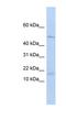 V-Set Pre-B Cell Surrogate Light Chain 1 antibody, NBP1-70741, Novus Biologicals, Western Blot image 