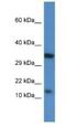 CAMP-Dependent Protein Kinase Inhibitor Beta antibody, NBP1-74255, Novus Biologicals, Western Blot image 