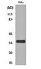 Secreted Frizzled Related Protein 2 antibody, orb161078, Biorbyt, Western Blot image 