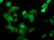 Deoxythymidylate Kinase antibody, LS-C173281, Lifespan Biosciences, Immunofluorescence image 