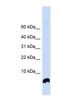 Glutaredoxin antibody, NBP1-56684, Novus Biologicals, Western Blot image 