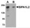 Signal Induced Proliferation Associated 1 Like 2 antibody, NBP1-77090, Novus Biologicals, Western Blot image 