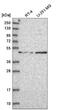 Fucosyltransferase 8 antibody, NBP2-58933, Novus Biologicals, Western Blot image 