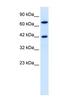 TOX High Mobility Group Box Family Member 2 antibody, NBP1-79964, Novus Biologicals, Western Blot image 