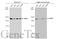 SWI/SNF Related, Matrix Associated, Actin Dependent Regulator Of Chromatin, Subfamily A, Member 4 antibody, GTX132121, GeneTex, Western Blot image 