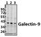 Gal-9 antibody, A03415-1, Boster Biological Technology, Western Blot image 