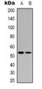 p53 antibody, orb339074, Biorbyt, Western Blot image 