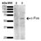 Fos Proto-Oncogene, AP-1 Transcription Factor Subunit antibody, LS-C774974, Lifespan Biosciences, Western Blot image 