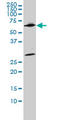 WD Repeat Domain 20 antibody, LS-B4542, Lifespan Biosciences, Western Blot image 