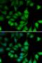 RNA Polymerase II Subunit H antibody, orb247699, Biorbyt, Immunocytochemistry image 