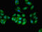 TPD52 Like 2 antibody, LS-C679870, Lifespan Biosciences, Immunofluorescence image 