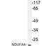 NDUFA4 Mitochondrial Complex Associated antibody, LS-C177858, Lifespan Biosciences, Western Blot image 