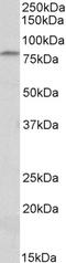 Adhesion G Protein-Coupled Receptor E5 antibody, LS-C186461, Lifespan Biosciences, Western Blot image 