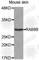 RAB8B, Member RAS Oncogene Family antibody, A3678, ABclonal Technology, Western Blot image 