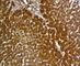 Glypican 3 antibody, V2538IHC-7ML, NSJ Bioreagents, Immunohistochemistry paraffin image 