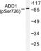 SRBP1 antibody, LS-C192152, Lifespan Biosciences, Western Blot image 