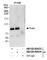 DNA Polymerase Eta antibody, NB100-60423, Novus Biologicals, Western Blot image 