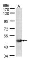 ALG1 Chitobiosyldiphosphodolichol Beta-Mannosyltransferase antibody, NBP1-32275, Novus Biologicals, Western Blot image 