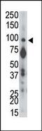 Protein Tyrosine Phosphatase Receptor Type A antibody, PA5-15522, Invitrogen Antibodies, Western Blot image 