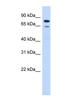 RecQ Mediated Genome Instability 1 antibody, NBP1-58133, Novus Biologicals, Western Blot image 