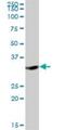 Dehydrogenase/Reductase 1 antibody, H00115817-B01P, Novus Biologicals, Western Blot image 