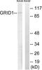 Glutamate Ionotropic Receptor Delta Type Subunit 1 antibody, PA5-38924, Invitrogen Antibodies, Western Blot image 