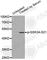 Glycogen Synthase Kinase 3 Alpha antibody, AP0120, ABclonal Technology, Western Blot image 