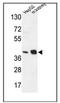 NADH:Ubiquinone Oxidoreductase Subunit A10 antibody, AP52837PU-N, Origene, Western Blot image 