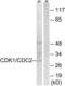 Cyclin Dependent Kinase 2 antibody, LS-C117638, Lifespan Biosciences, Western Blot image 