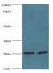 Charged Multivesicular Body Protein 5 antibody, A57253-100, Epigentek, Western Blot image 