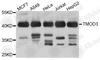 Tropomodulin 3 antibody, A4671, ABclonal Technology, Western Blot image 